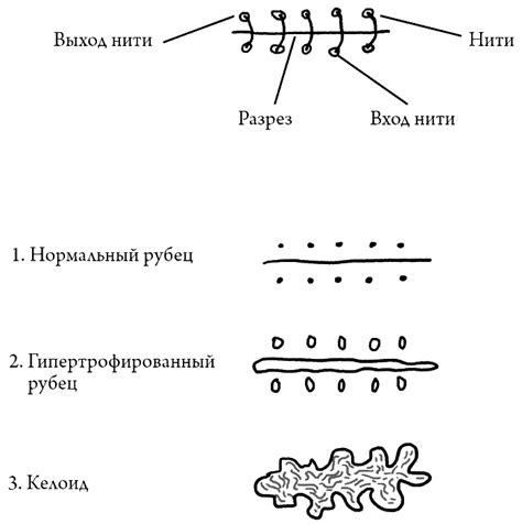 Объяснение возникновения шрама