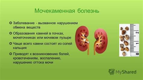 Опасность образования сгустков крови в мочевом пузыре