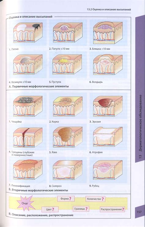 Описание проявлений кожных высыпаний