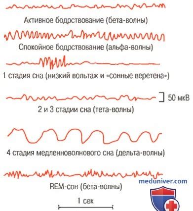 Оптимальная частота проведения электроэнцефалограммы