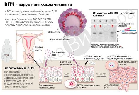 Осложнения ВПЧ 52 у женщин