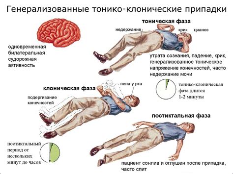 Основной симптом трясения