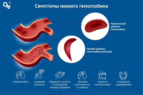 Основные причины низкого уровня гемоглобина