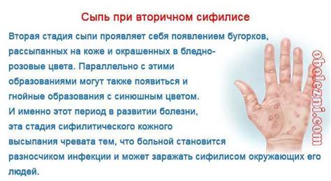 Основные причины появления сыпи