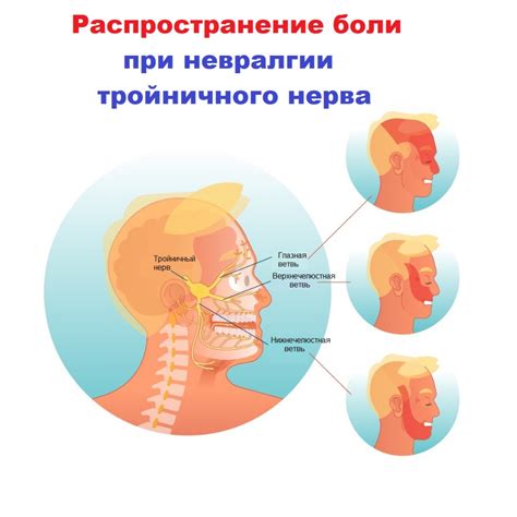 Основные симптомы задевания нерва