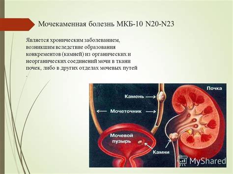 Особенности образования органических камней