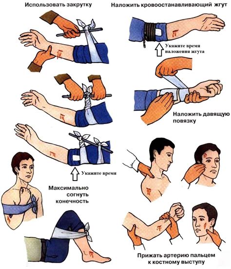 Остановить кровотечение с помощью стерильного бинта