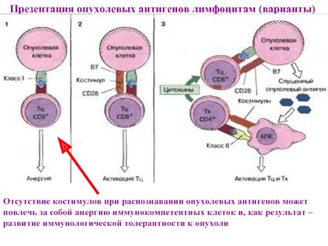 Отсутствие сдавления опухолевых клеток