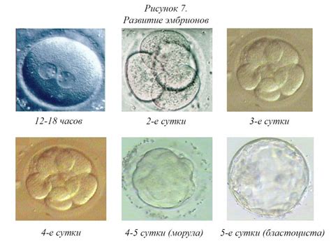 Оценка качества и выбор эмбрионов для трансфера