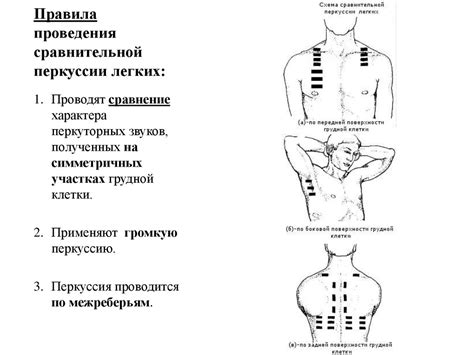 Перкуторные точки