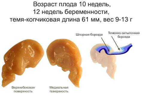 Поверхность плода