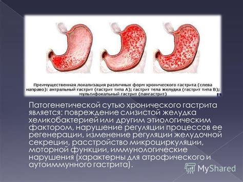 Повреждение желудочной слизистой