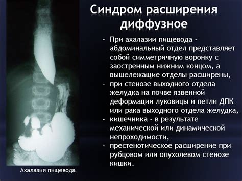 Повреждения желудочно-кишечного тракта