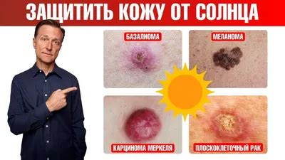 Повреждения кожи от солярия после удаления волос