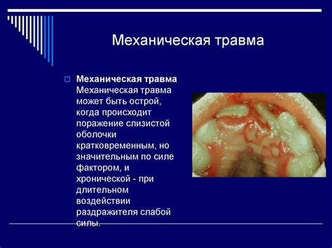 Повреждения слизистой оболочки и последствия травм