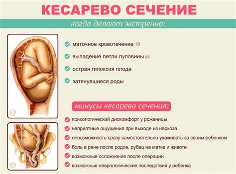 Показания для кесарева сечения