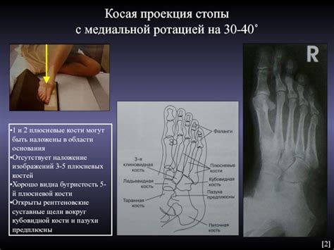 Польза боковой проекции