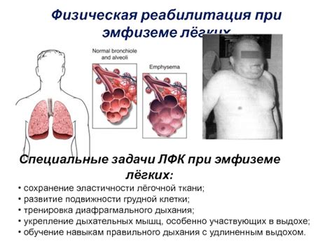 Польза правильного дыхания при эмфиземе