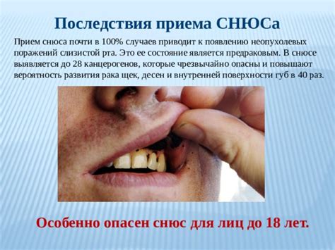 Последствия наличия снюса