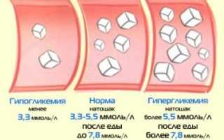 Последствия нестабильного уровня глюкозы