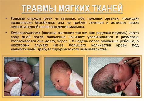 Последствия родовых травм и инфекций