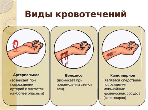 Последствия самостоятельной остановки кровотечения