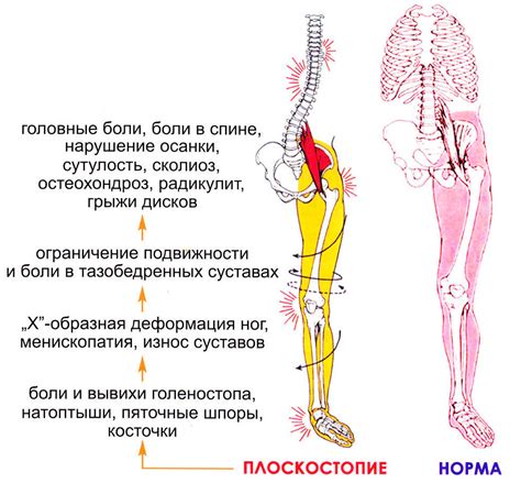 Почему важно идти в моих стопах