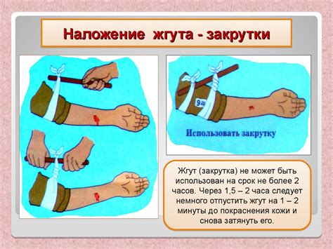 Почему жгут запрещен