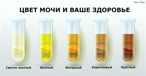 Почему у женщин моча может быть салатового цвета?