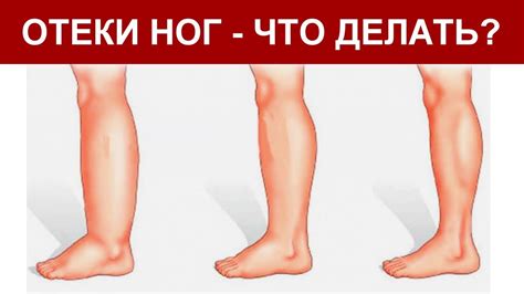 Почему чешется ноги?