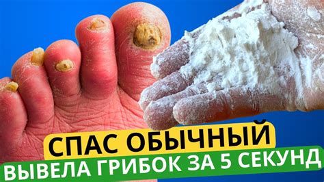 Появление грибков на продуктах