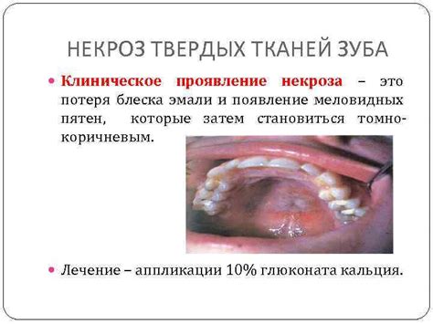 Появление микроцарапин и потеря блеска