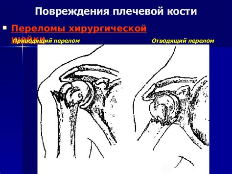 Предотвращение травматических повреждений