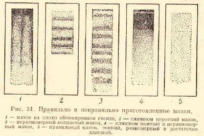 Приготовление препарата для мазка