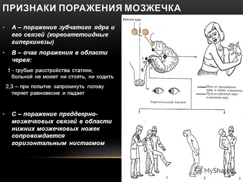 Признаки поражения