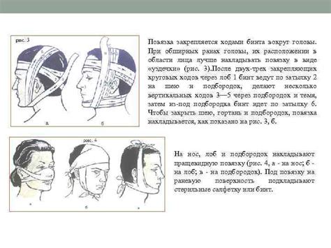 Применение стерильных повязок