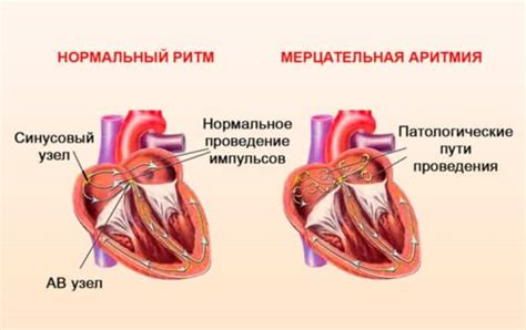 Принципы применения лекарств для лечения сердцебиения