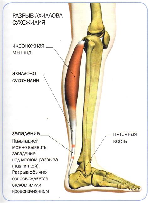 Причина #1: Мышцы и сухожилия