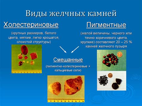 Причины возникновения желчи и злобы у людей