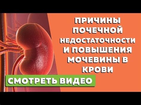 Причины накопления мочевины