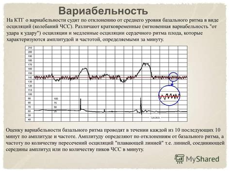 Причины низкой активности на КТГ