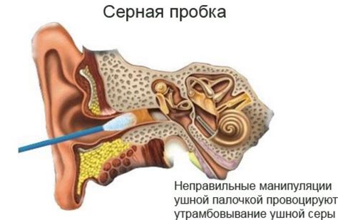 Причины появления коричневой серы в ухе