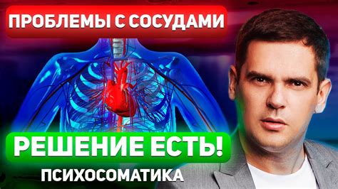 Проблемы с сосудами