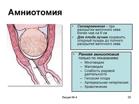 Прокол пузыря: влияние на процесс родов