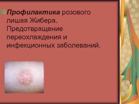 Профилактика и предотвращение рецидивов розового лишая
