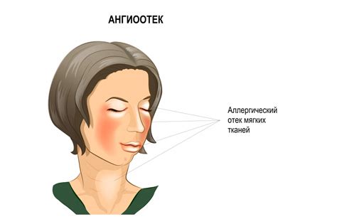 Профилактика отека лица у детей