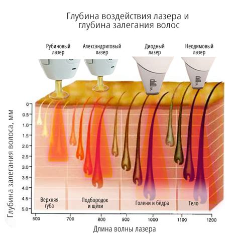 Процедуры эпиляции