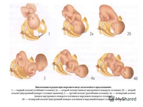 Процесс выхода головки ребенка