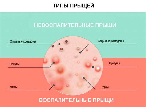 Прыщ на яичке: как определить, что это именно простуда