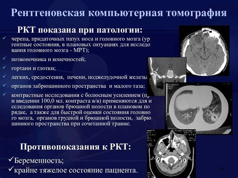 Различия между компьютерной томографией и КТ-ангиографией